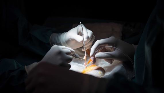 На Чернігівщині у блекаут хірург оперував із налобним ліхтариком: «Апендикс лопнув у мене на руці. Встигли витягти»