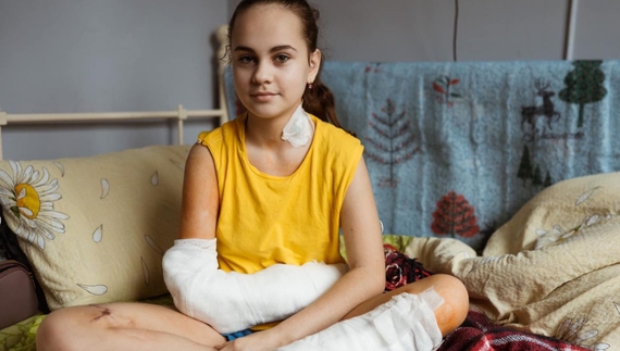 Як 12-річна чернігівка Ксенія, яка дивом вижила після удару по драмтеатру, проходить лікування в Охматдиті