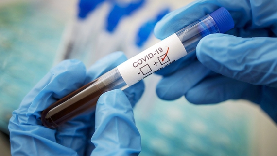 За тиждень на коронавірус захворіли більше 7 тисяч жителів Чернігівщини