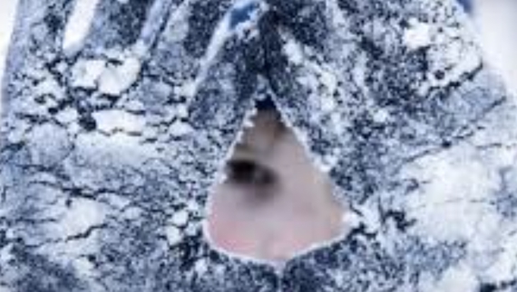 Чи були п’яними: в обласній лікарні розповіли про хворих із обмороженнями