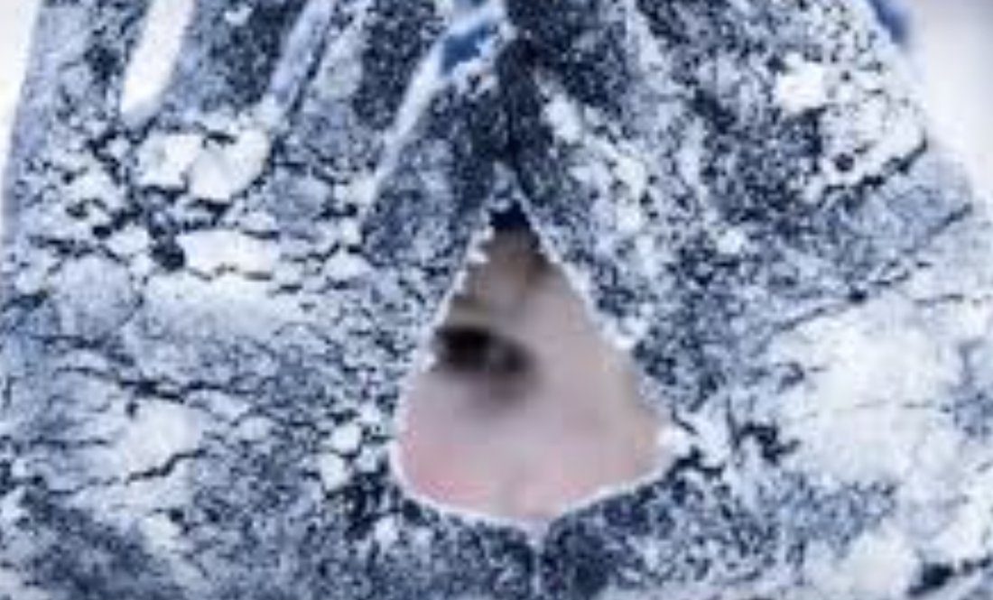 Чи були п’яними: в обласній лікарні розповіли про хворих із обмороженнями