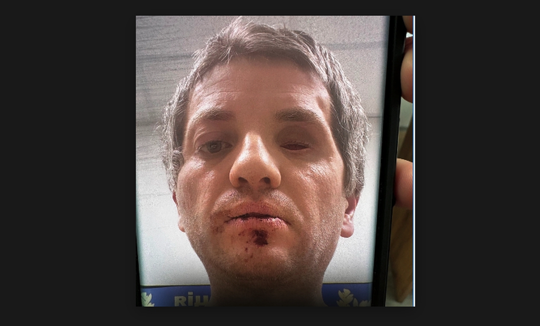 Випав протез з ока: після затримання патрульними ветеран потрапив у лікарню. Що кажуть правоохоронці