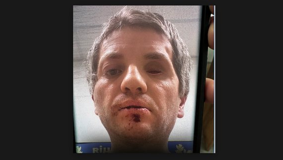 Випав очний протез: після "спілкування" з патрульними ветеран потрапив у лікарню. Що кажуть правоохоронці