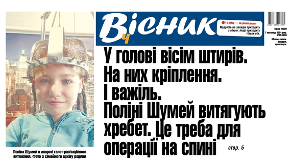 У голові вісім штирів: дівчинці із Чернігівщини витягують хребет. Читайте у "Віснику"