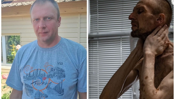 У полоні схуд на 45 кілограмів