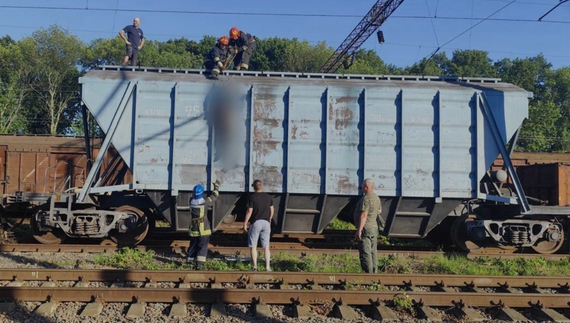 Як почуває себе дівчина з Ніжина, яка зазнала ураження електрострумом на даху потяга?