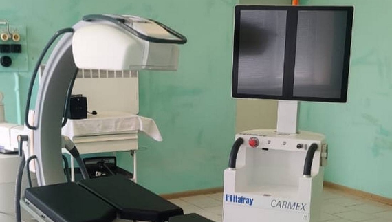 Лікарня в Бобровиці отримала сучасний рентген-апарат: хто платитиме за знімки