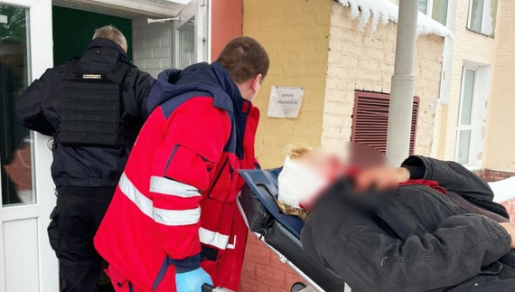 Ворог обстріляв три громади на Чернігівщині: є поранені та пожежі