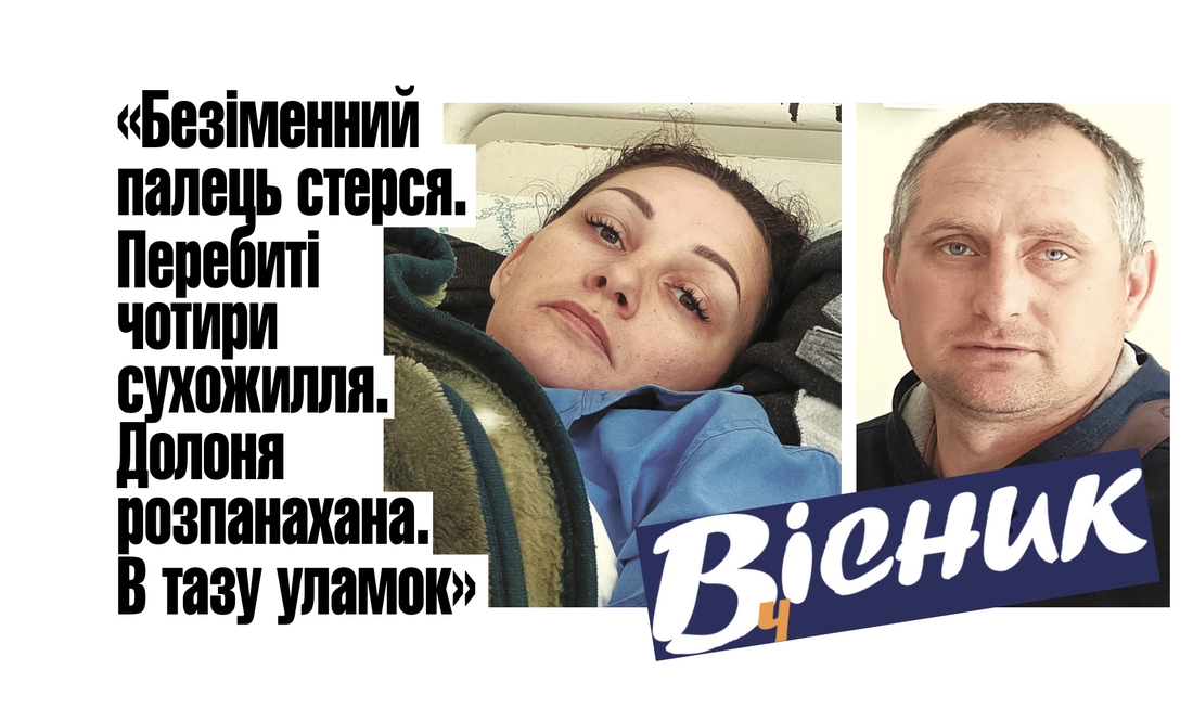 Продавщиця, поранена у Сновську, прооперована в Корюківській лікарні. Читайте у "Віснику"