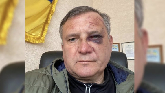 Допити і тортури: староста селища з Чернігівщини розповів про викрадення