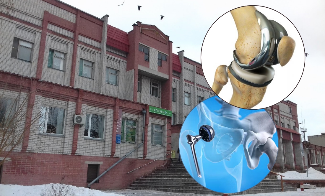 В Чернігівській районній лікарні ставлять ендопротези