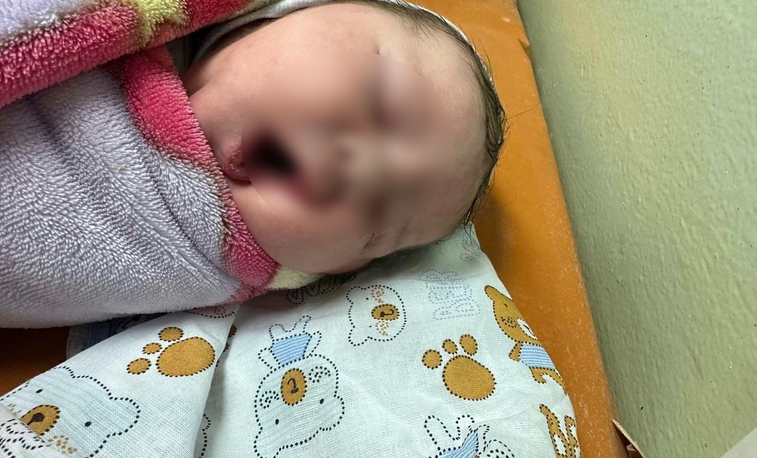 Катерина Козороз народила сина вагою 5170 грамів. Кесарів розтин робили у козелецькій лікарні