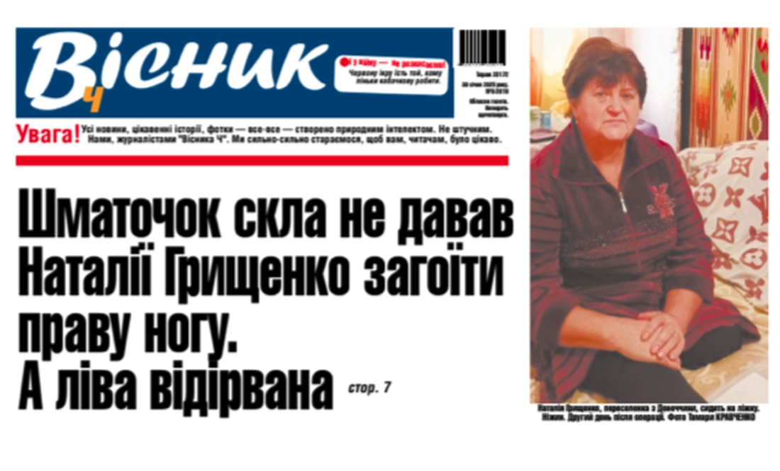 Шматочок скла не давав жінці загоїти праву ногу. А ліва відірвана. Читайте у "Віснику"