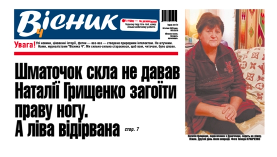 Шматочок скла не давав жінці загоїти праву ногу. А ліва відірвана. Читайте у "Віснику"