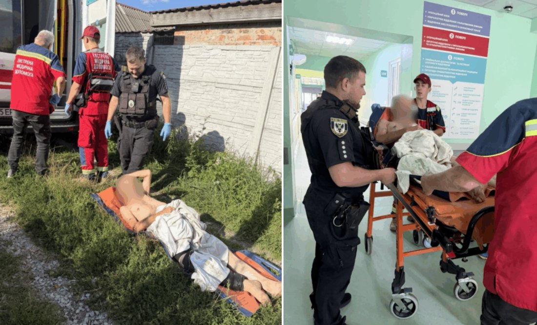 Прооперували і шукають прихисток: як громада у передмісті Чернігова рятує травмованого земляка