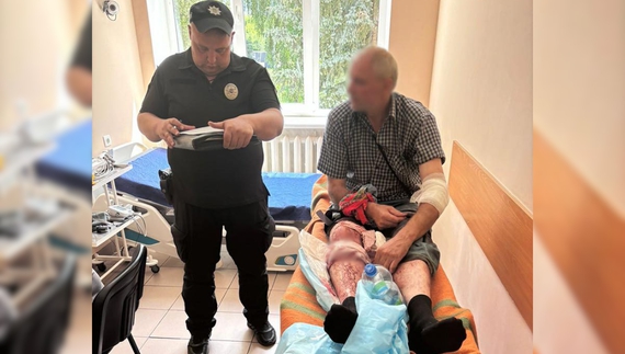 Житель Чернігівщини вийшов у двір - його атакував ворожий дрон