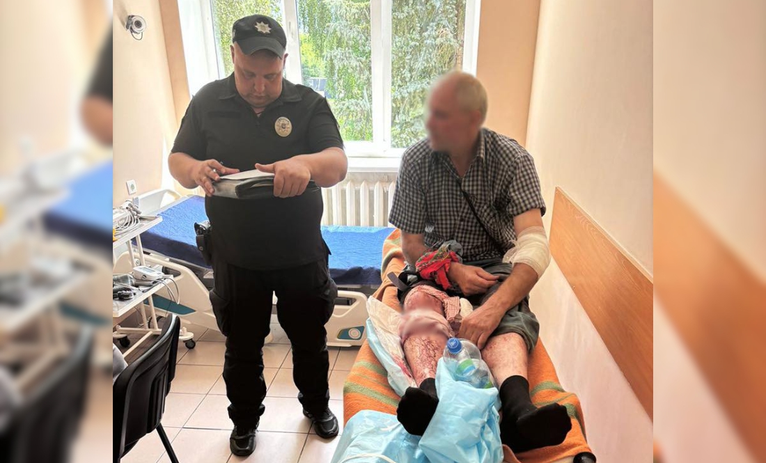 Житель Чернігівщини вийшов у двір - його атакував ворожий дрон