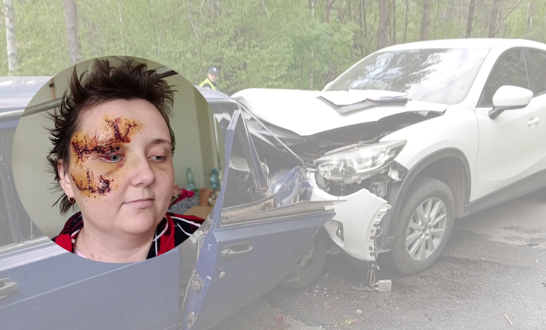 Оксана Ващенко в лікарні після аварії