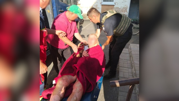 Володимир Криволап після удару російським дроном