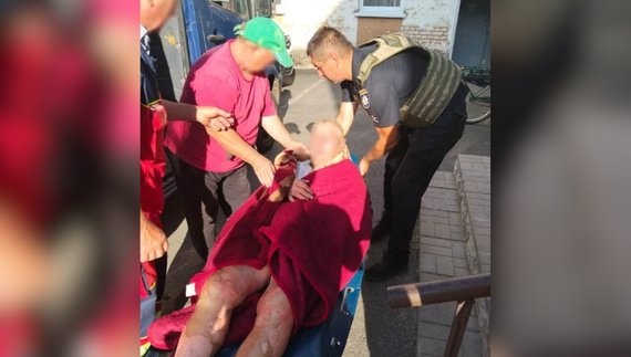 Володимир Криволап після удару російським дроном