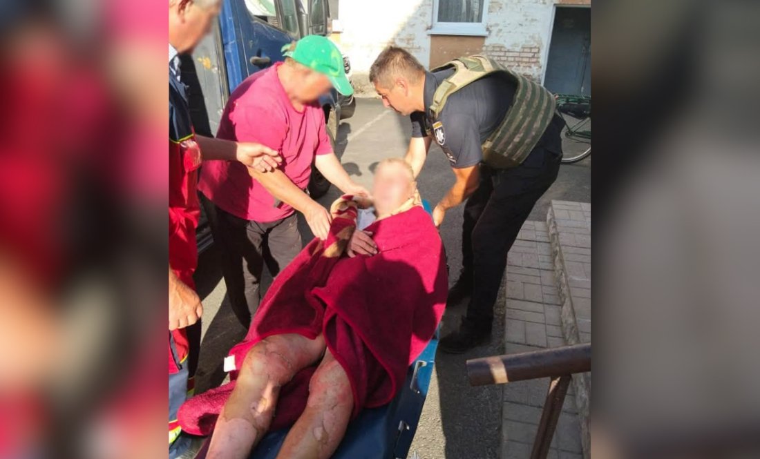 Володимир Криволап після удару російським дроном