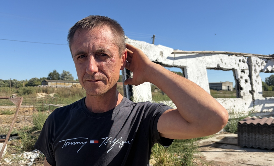 З мозку витягли уламки черепа та осколки: які лікували пораненого тракториста
