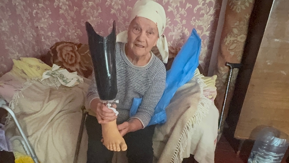 Любов Прочухан з протезом, який дали в Австрії