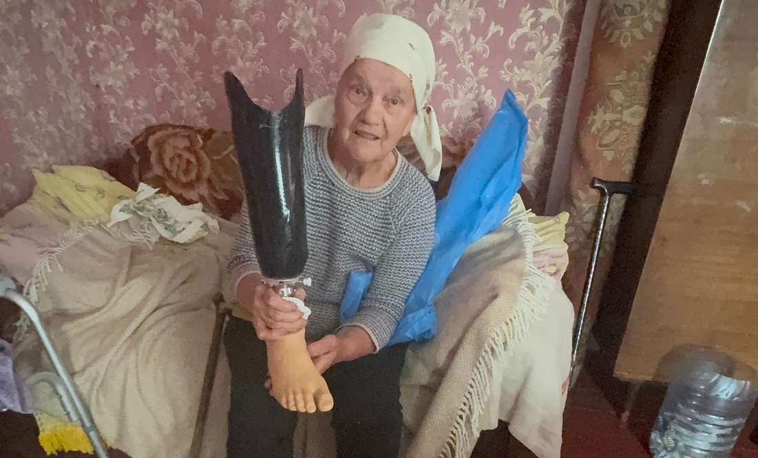 Любов Прочухан з протезом, який дали в Австрії