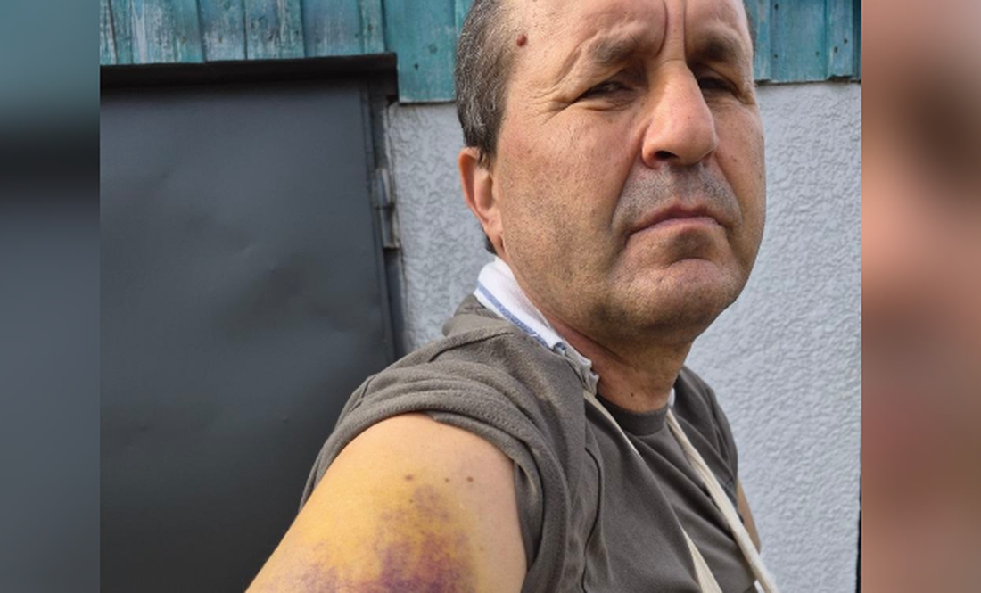 Валентин Прима, військовослужбовець, селище Козелець