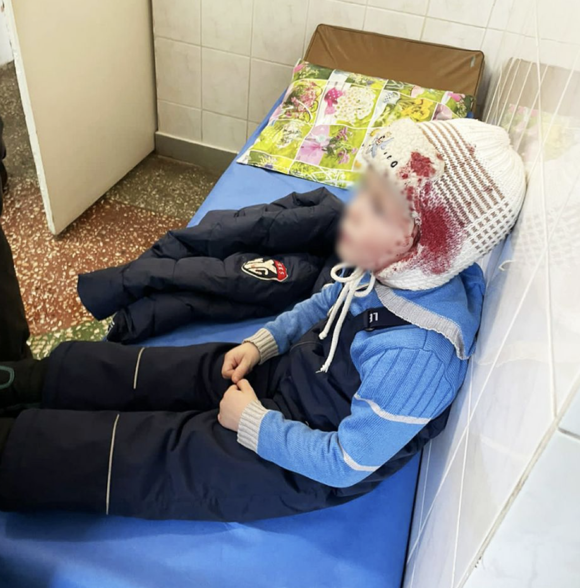 Чотирирічна дитина в шоковому стані після обстрілів