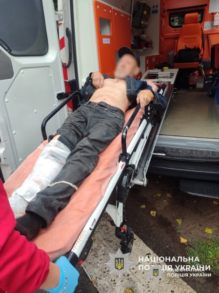 Поліцейський у Чернігові врятував чоловіка з відкритим переломом ноги
