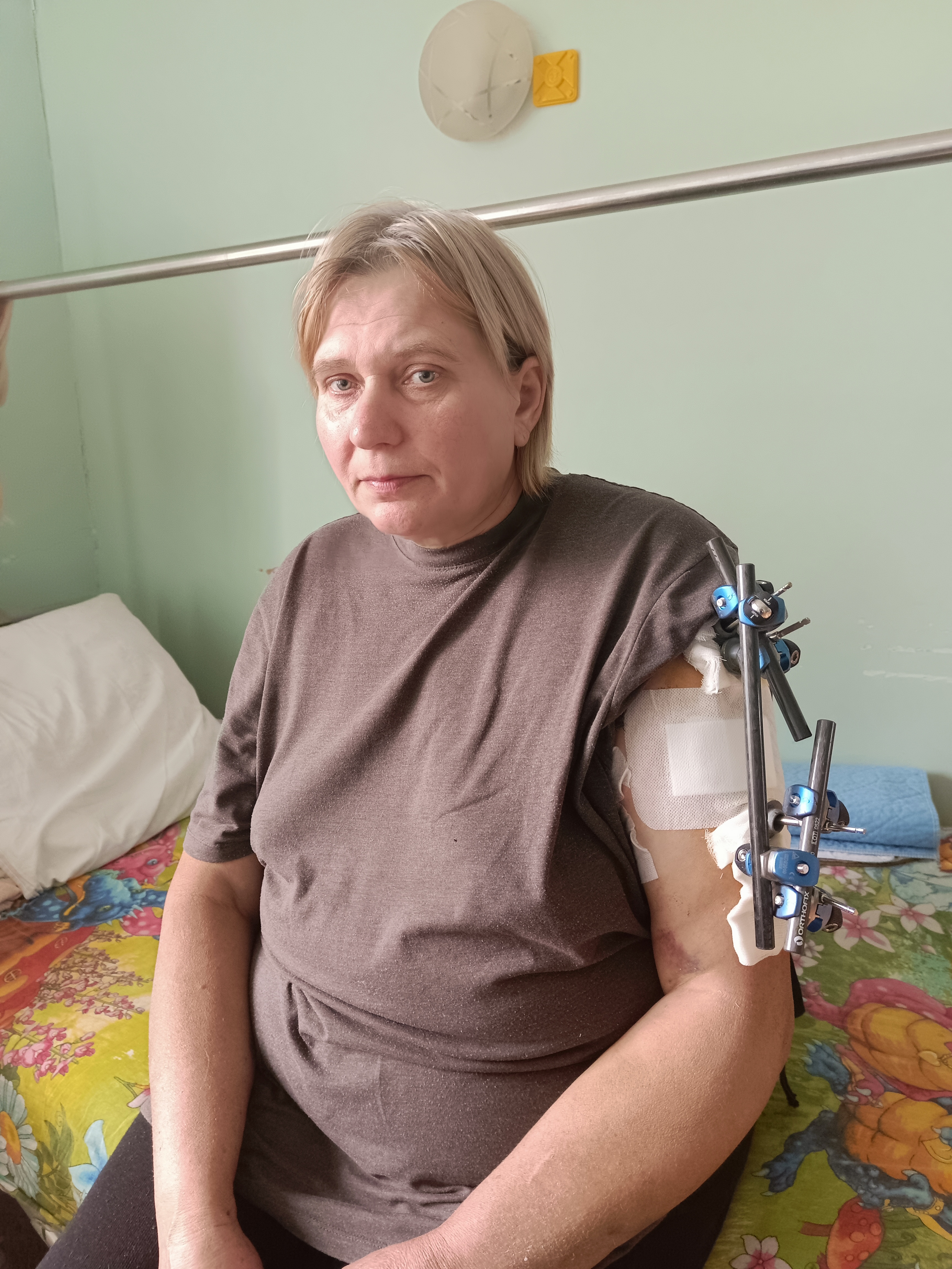 Світлана Іваненко. На руці стрижневий апарат