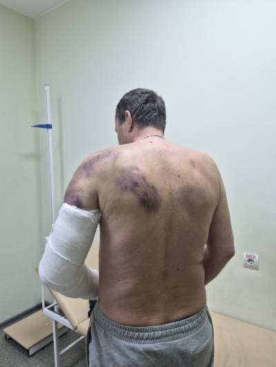 Військовий з Чернігівщини стверджує, що його побив керівник автодору