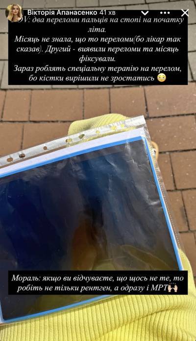 Міс Україна-Всесвіт Вікторія Апанасенко місяць ходила з переломами на стопі і не знала про це