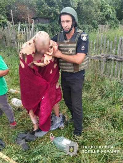 Данилович помер у лікарні: копав картоплю й отримав тяжкі опіки від вибуху дрона