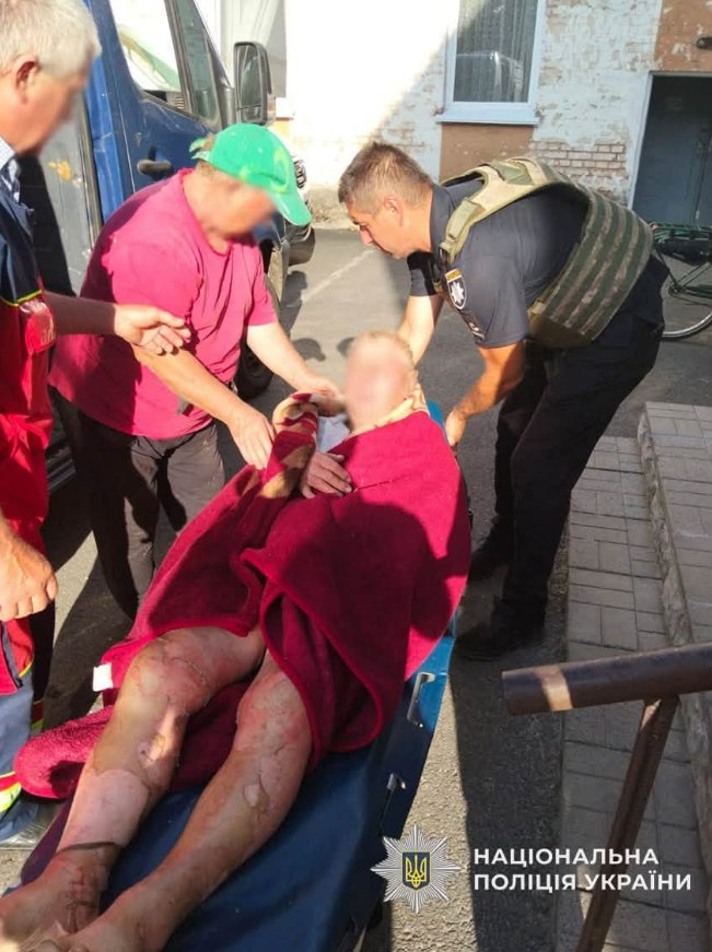 Данилович помер у лікарні: копав картоплю й отримав тяжкі опіки від вибуху дрона